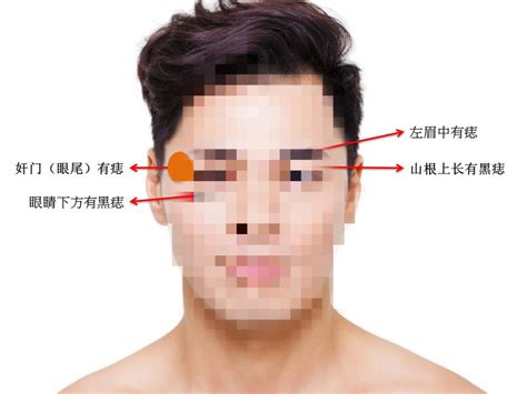 男生臉上很多痣|「臉痣」看健康、運勢！專家解析10種痣：眼下這顆痣。